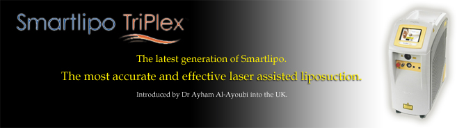Smartlipo Triplex by Dr Ayoubi