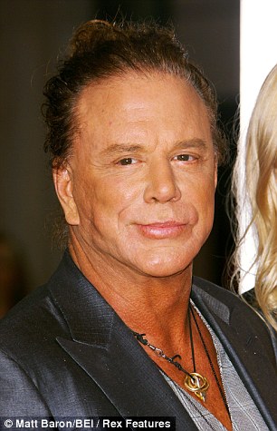 Mickey Rourke Fillers