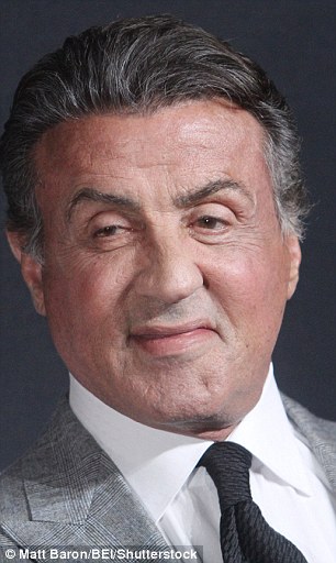 Sylvester Stallone Fillers