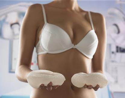 Breast augmentation