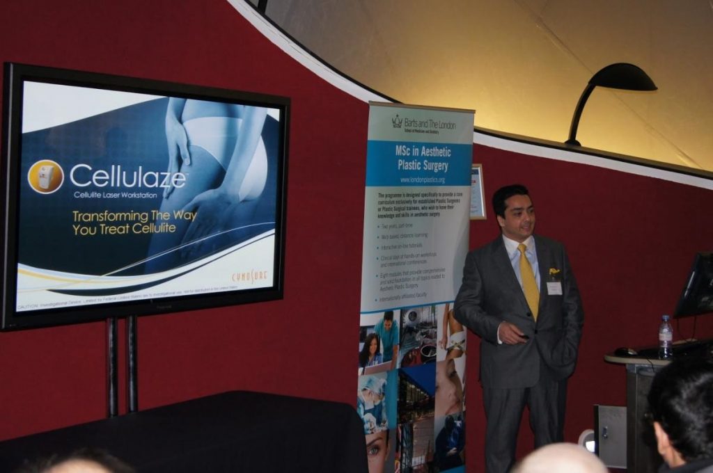 Smartlipo revolutionized liposuction