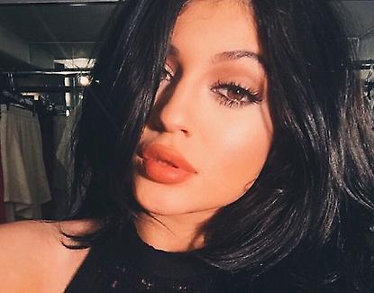 Lip fillers for lip enhancement