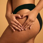 Goodbye to Cellulite