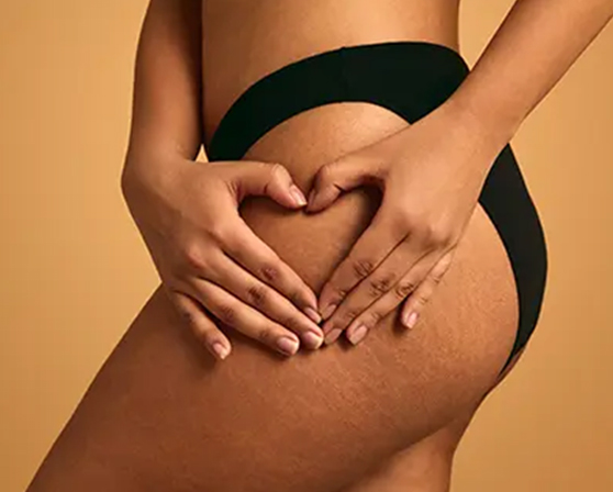 Goodbye to Cellulite